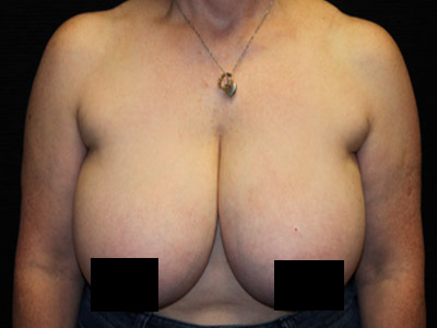 5056 Before Image