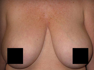 56962 Before Image