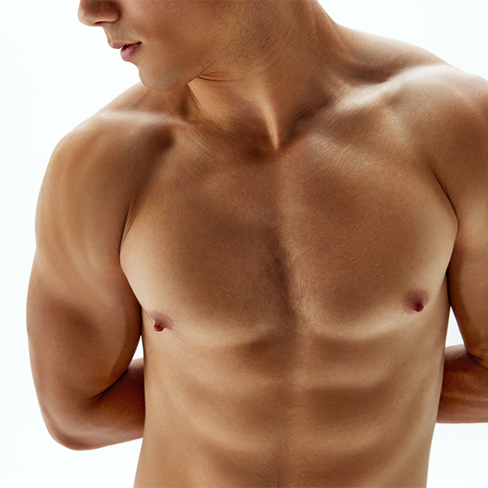 Gynecomastia Image