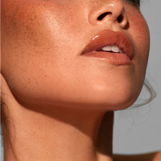 Forma Skin Tightening Image