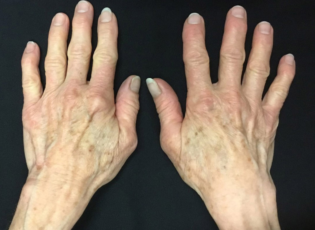 Patient #50389: 3 For Me Refresh Before Image