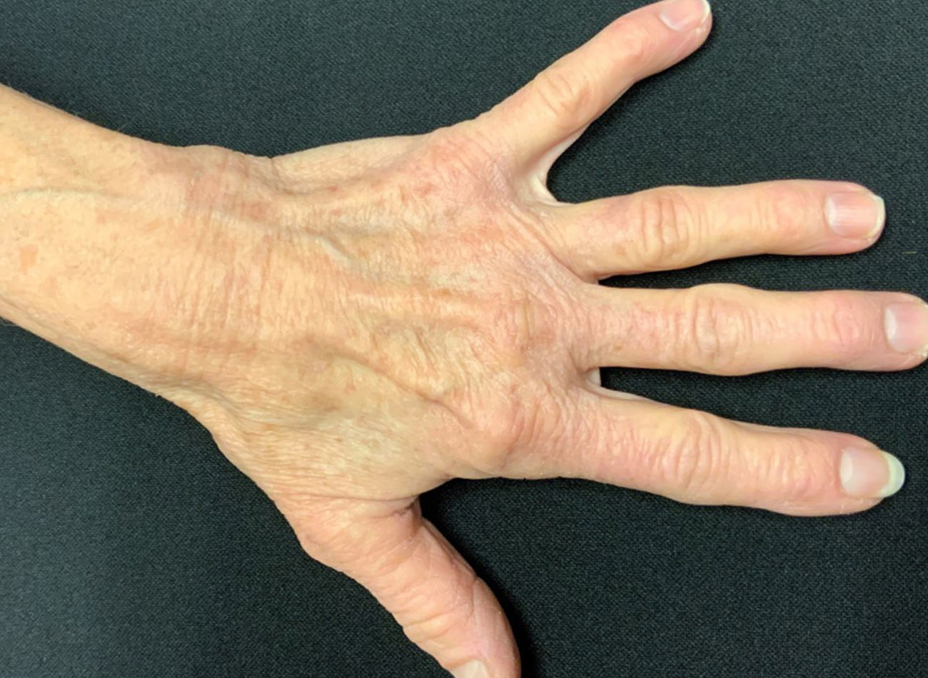 Patient #50389: 3 For Me Refresh After Image