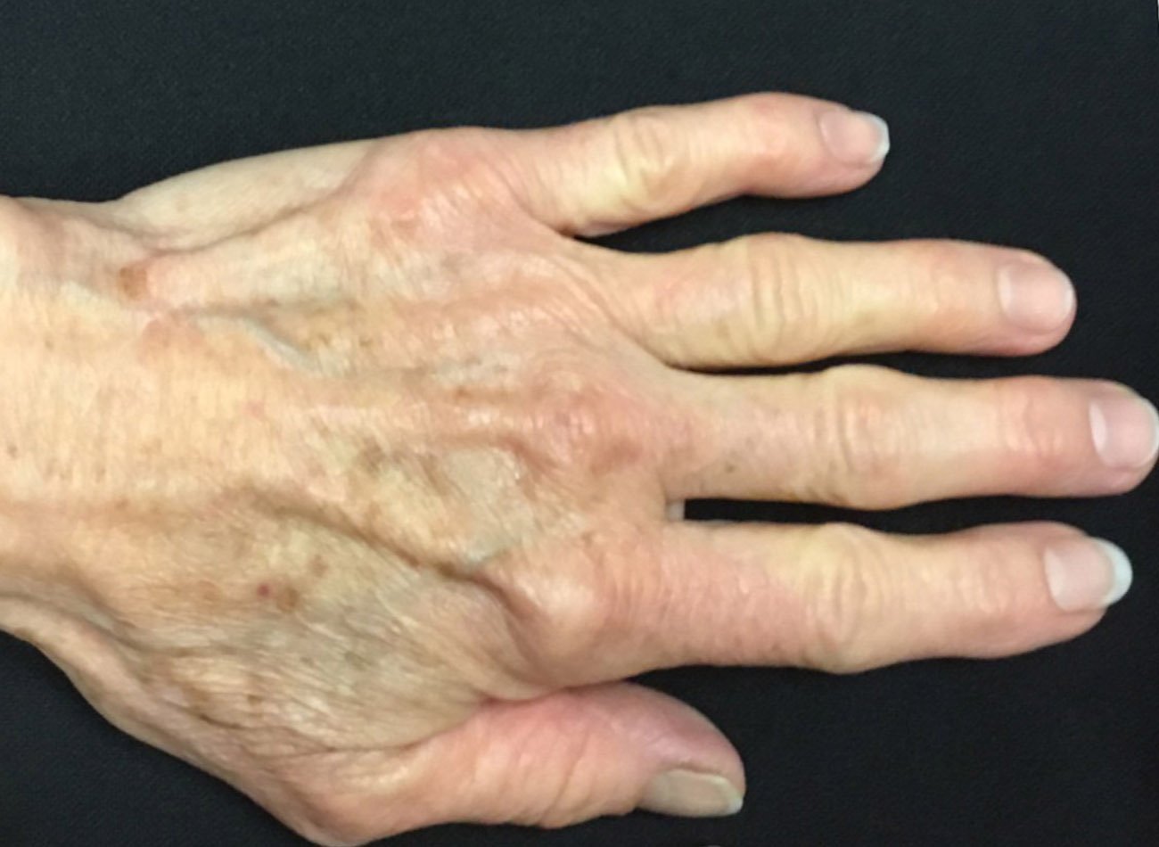 Patient #50389: 3 For Me Refresh Before Image