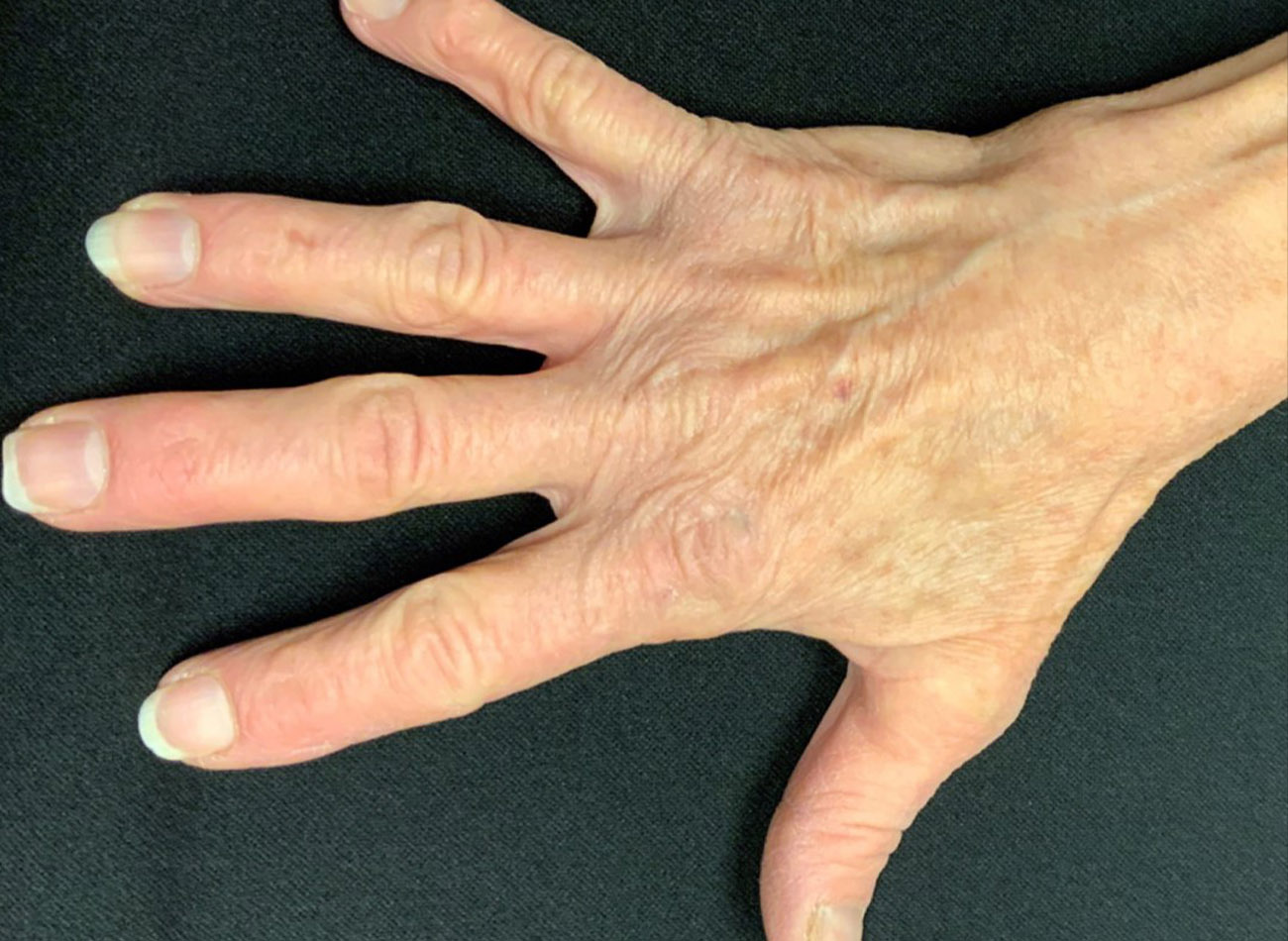 Patient #50389: 3 For Me Refresh After Image