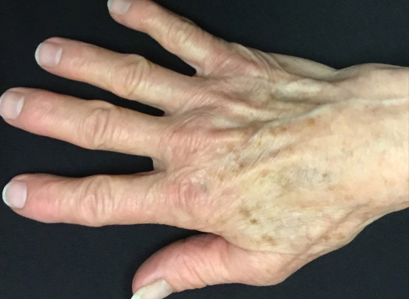 Patient #50389: 3 For Me Refresh Before Image