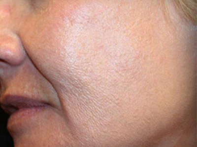 Patient #85093: 3 For Me After Image