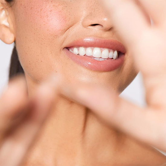 Juvéderm® Volbella Image