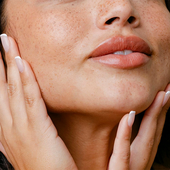 Juvéderm® Vollure Image