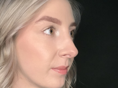 Patient #22669: Rhinoplasty After Image