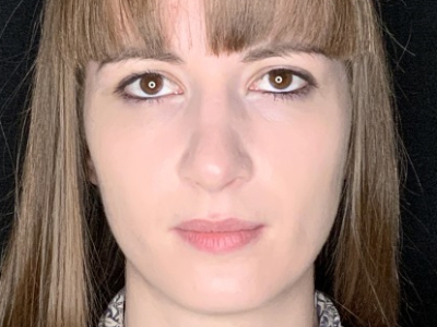 Patient #69547: Rhinoplasty After Image