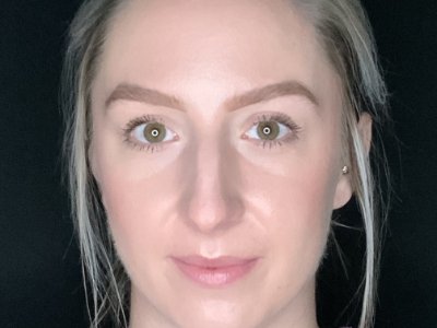 Patient #22669: Rhinoplasty Before Image