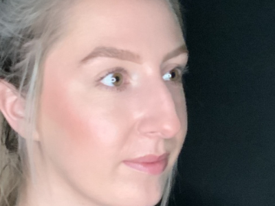 Patient #22669: Rhinoplasty Before Image