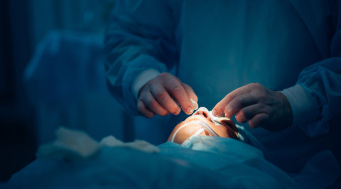Steps to Take Before a Rhinoplasty Image