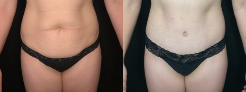 Patient # 92468 Combine Image