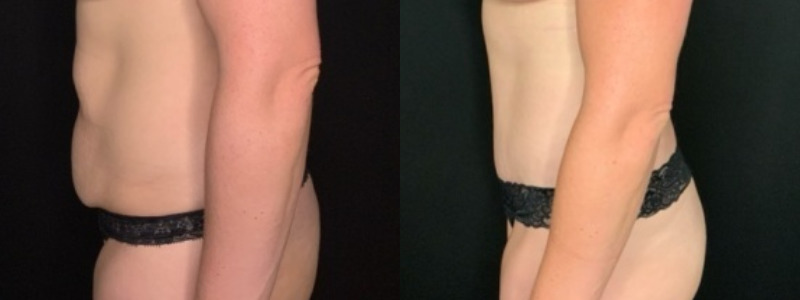 Patient # 92468 Combine Image