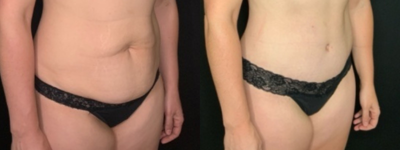 Patient # 92468 Combine Image