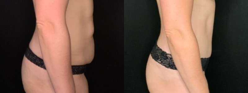 Patient # 92468 Combine Image